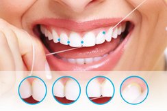 Professionelle Zahnreingigung - Reinigung der Zahnzwischenräume mit Zahnseide